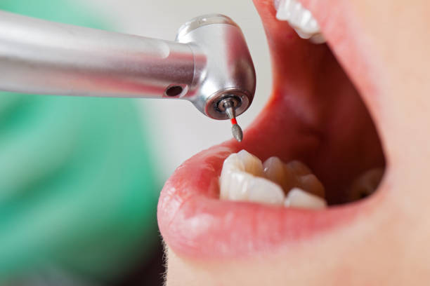 Best Tooth Infection Emergency Dentist  in Bostonia, CA
